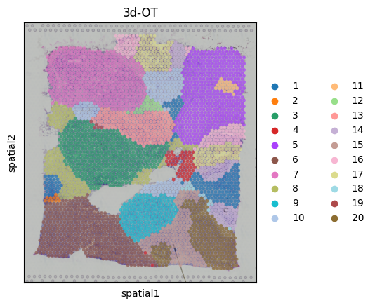 ../_images/Single_Omics_spatial_domain_identification_Breast_cancer_15_0.png