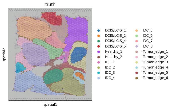 ../_images/Single_Omics_spatial_domain_identification_Breast_cancer_7_0.png