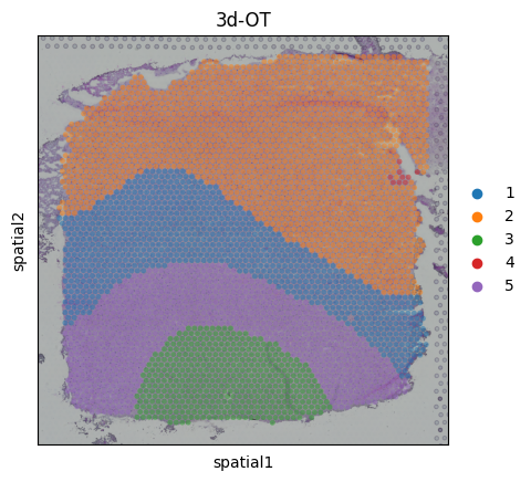../_images/Single_Omics_spatial_domain_identification_DLPFC12slices_95_0.png